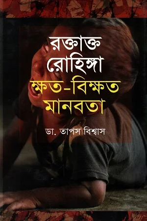 রক্তাক্ত রোহিঙ্গা : ক্ষত-বিক্ষত মানবতা